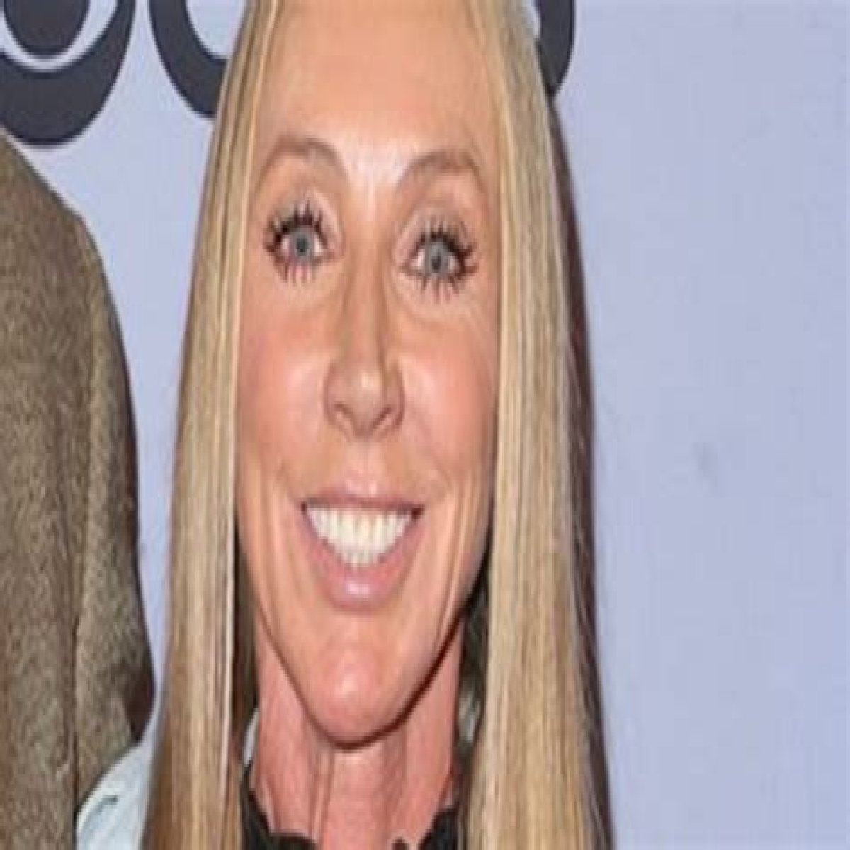 Net Worth, “Cats”, Daughter Hannah Margaret, Plastic Surgery