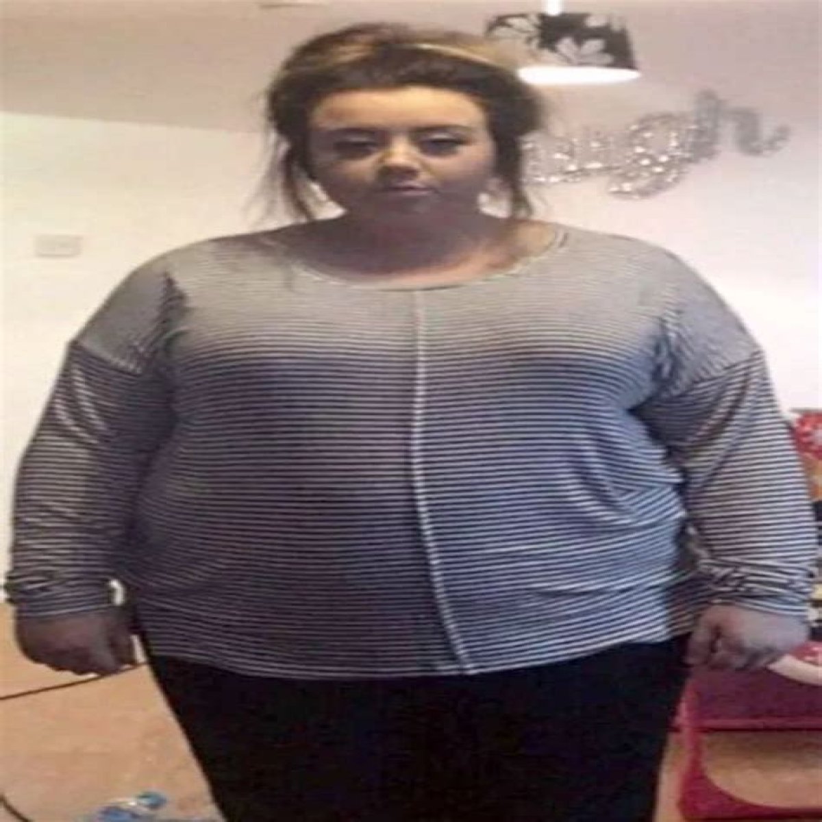 ‘So much fat!’ – the cruel autopsy of a 17-stone woman on the BBC